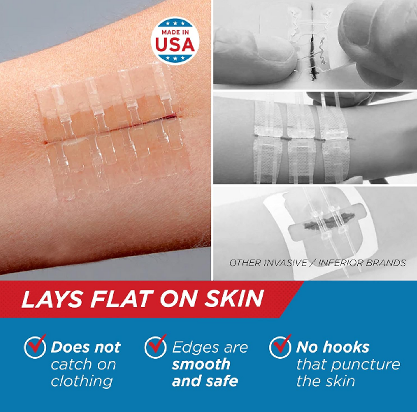 Cilifer® Emergency Laceration Closures - Repair Wounds Without Stitches. FSA HSA Eligible Skin Closure Device for 2 Individual Wounds Or Combine for Total Length of 2 Inches
