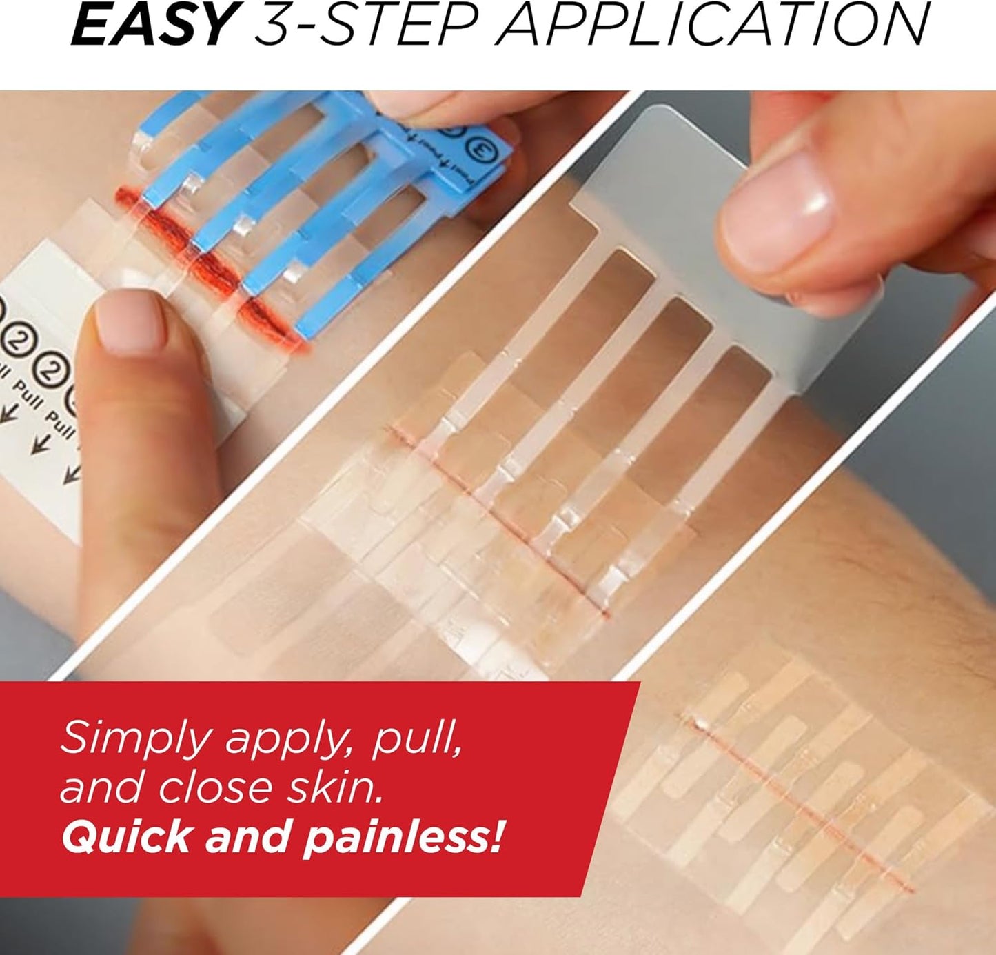 Cilifer® Emergency Laceration Closures - Repair Wounds Without Stitches. FSA HSA Eligible Skin Closure Device for 2 Individual Wounds Or Combine for Total Length of 2 Inches