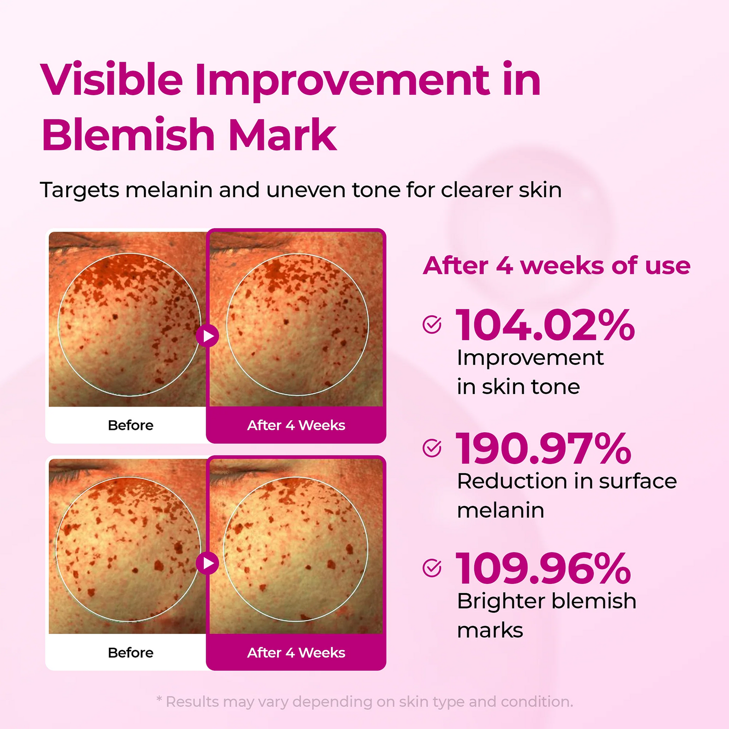 LUHAKA® Pore & Spot Care Duo