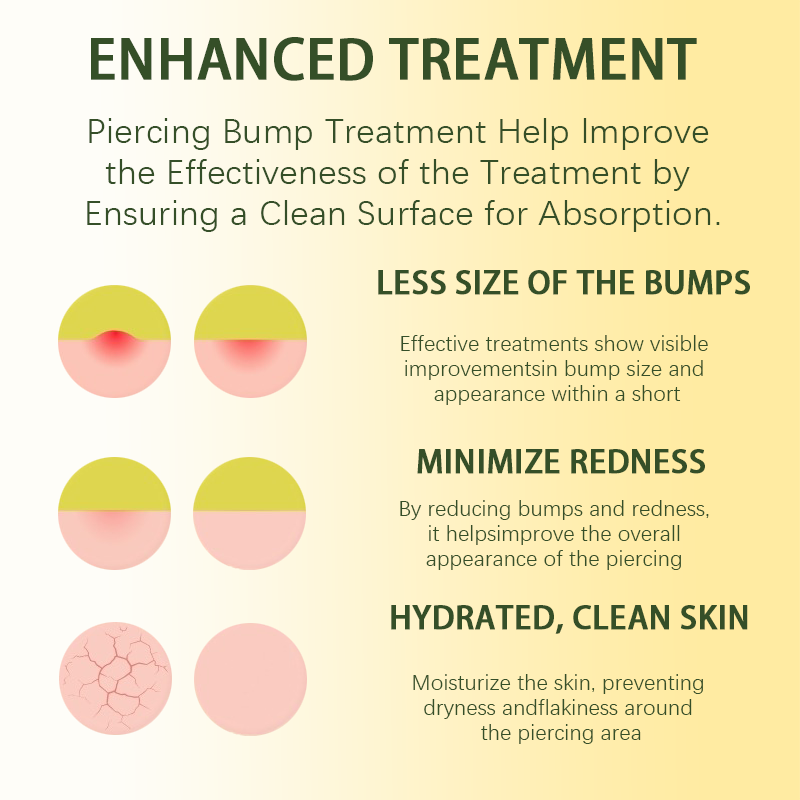 LUHAKA® Piercing Bump Solution I Keloid Bump Removal - Soothing Essential Oil for Piercing Bumps, Keloids & Scars | Nose, Ears, Body