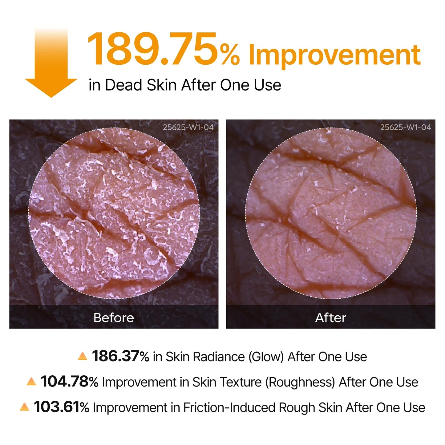 Luhaka® DermPeel Kojic Acid Turmeric Spray