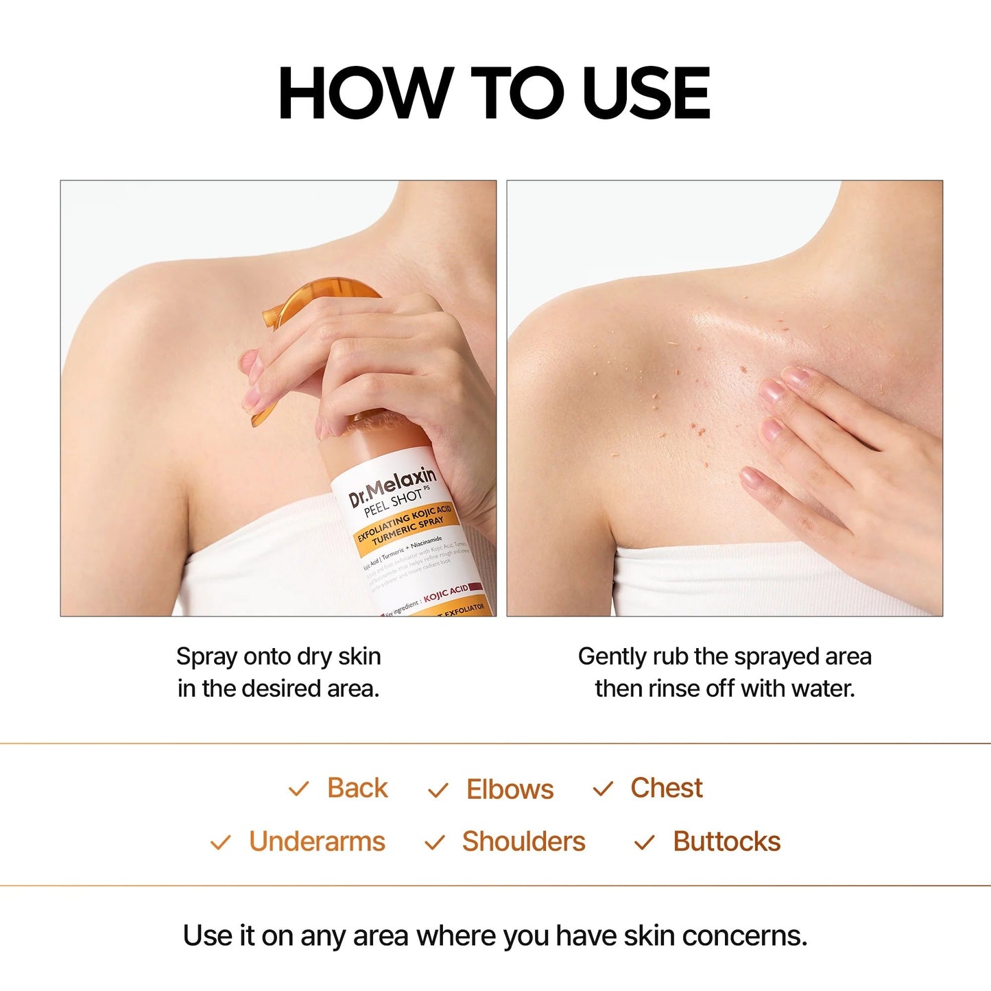 Luhaka® DermPeel Kojic Acid Turmeric Spray