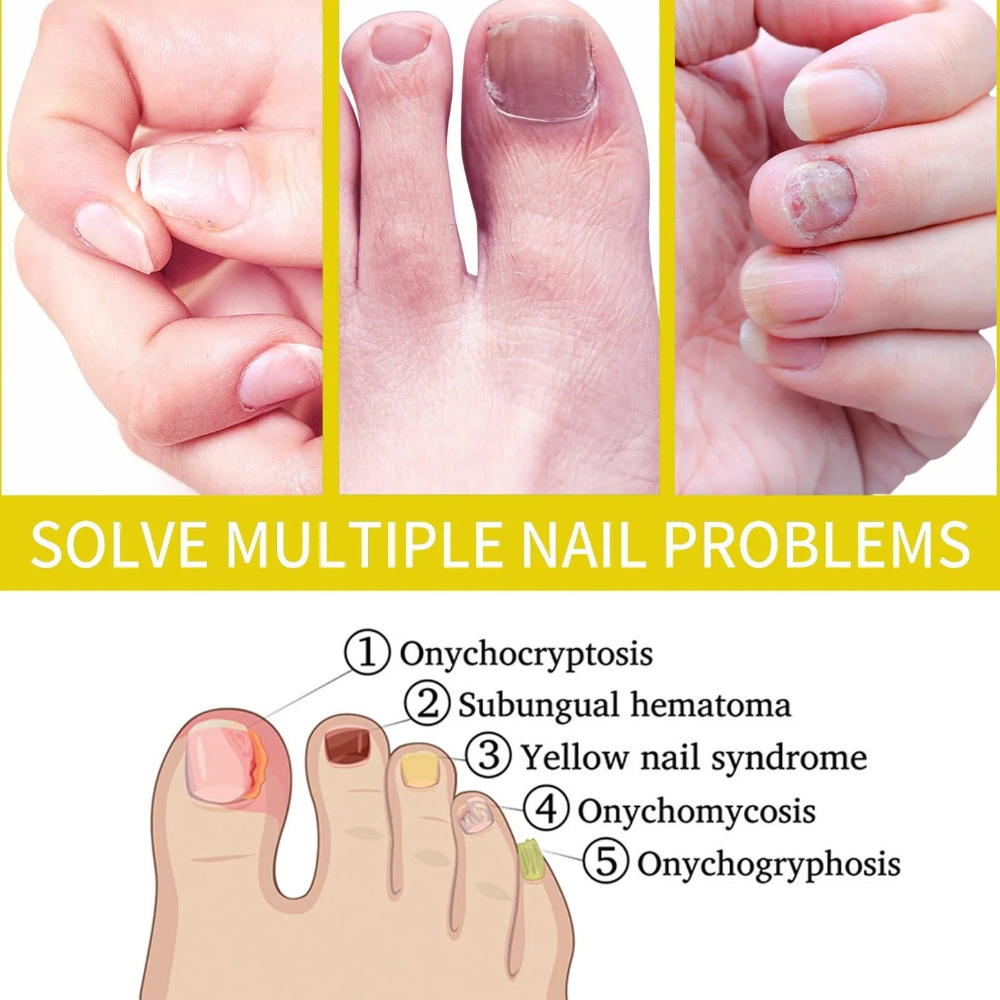 Cilifer® Nail Growth Oil
