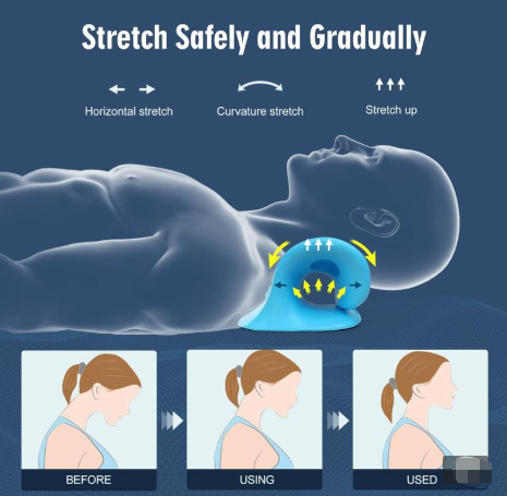 CZTICLE® Neck Stretcher for Pain Relief,Neck Hump Corrector,Neck and Shoulder Relaxer Cervical Traction Device Pillow for Muscle Relax and TMJ Pain Relief (Blue)