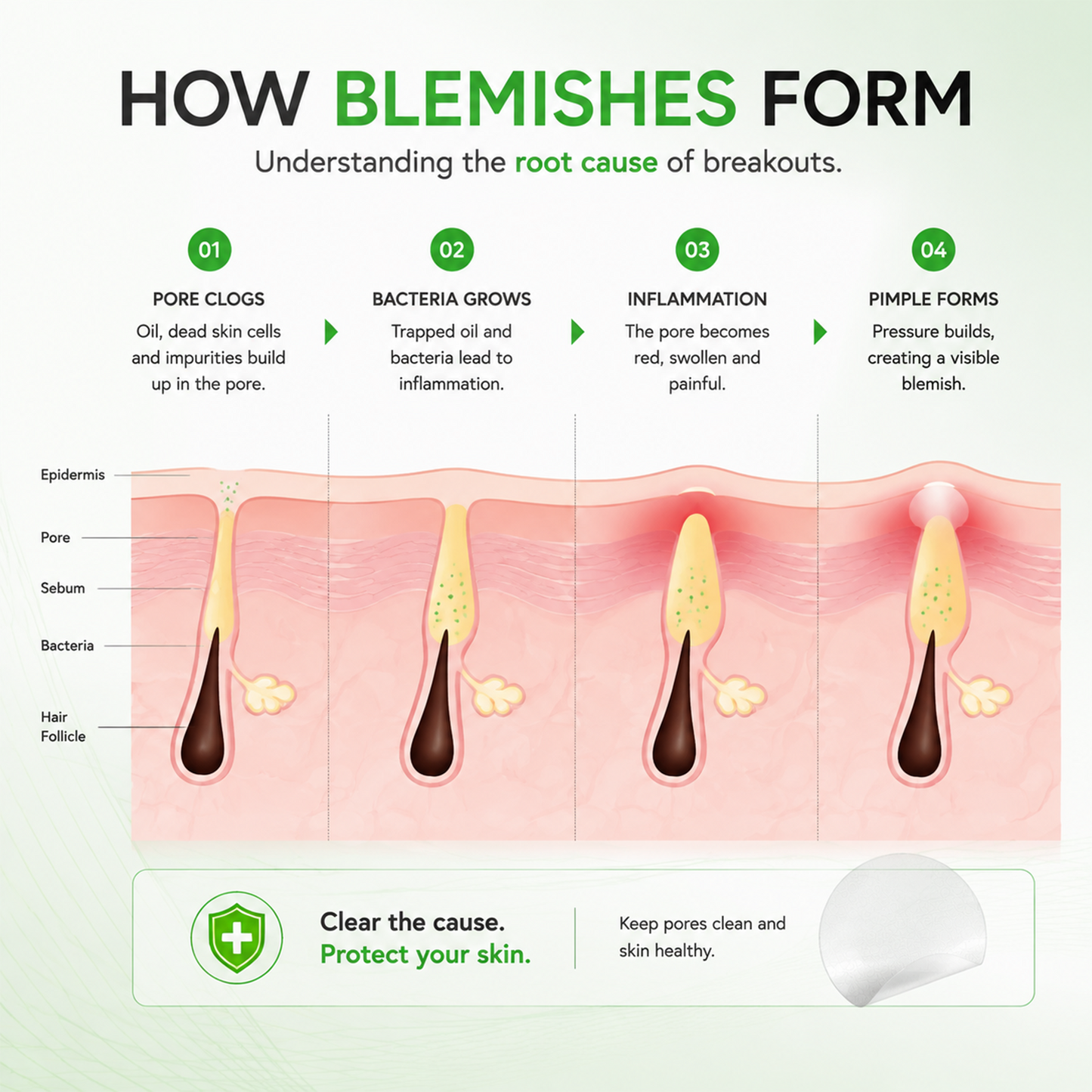 LUHAKA® Invisible Blemish Patch - Thin Hydrocolloid Acne Patches