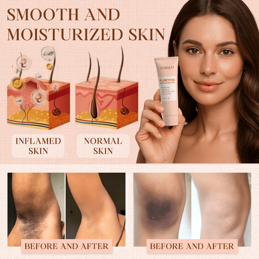 Luhaka® Purifying Exfoliating Gel ACE 1 for Acanthosis Nigricans, Exfoliation, Dark Spots, Skin Tags, and Eczema