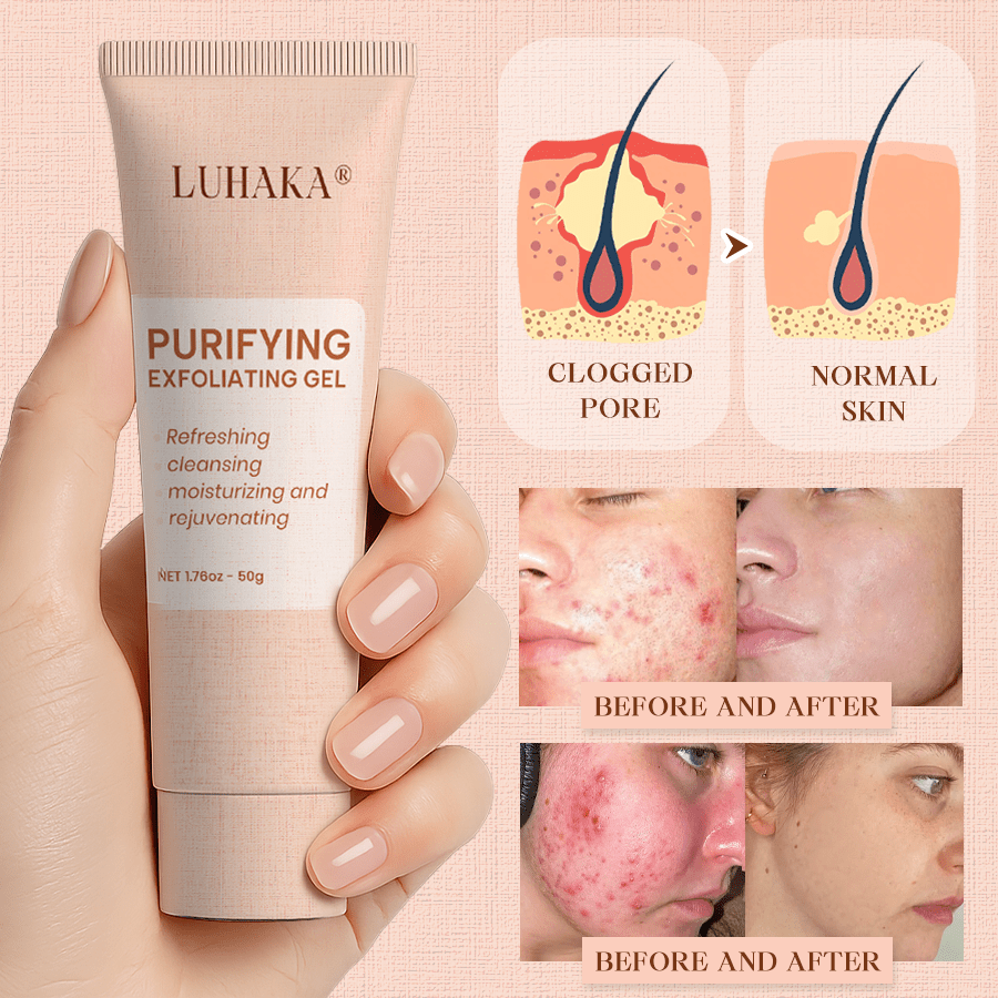 Luhaka® Purifying Exfoliating Gel ACE 1 for Acanthosis Nigricans, Exfoliation, Dark Spots, Skin Tags, and Eczema