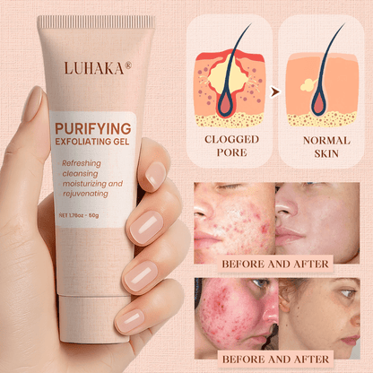 Luhaka® Purifying Exfoliating Gel ACE 1 for Acanthosis Nigricans, Exfoliation, Dark Spots, Skin Tags, and Eczema