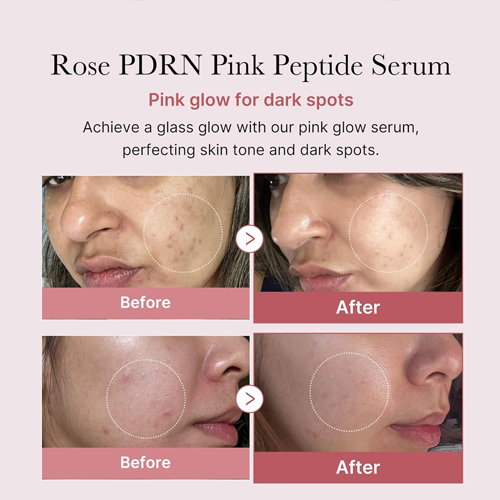 LUHAKA®  Pink Peptide Serum 30ml
