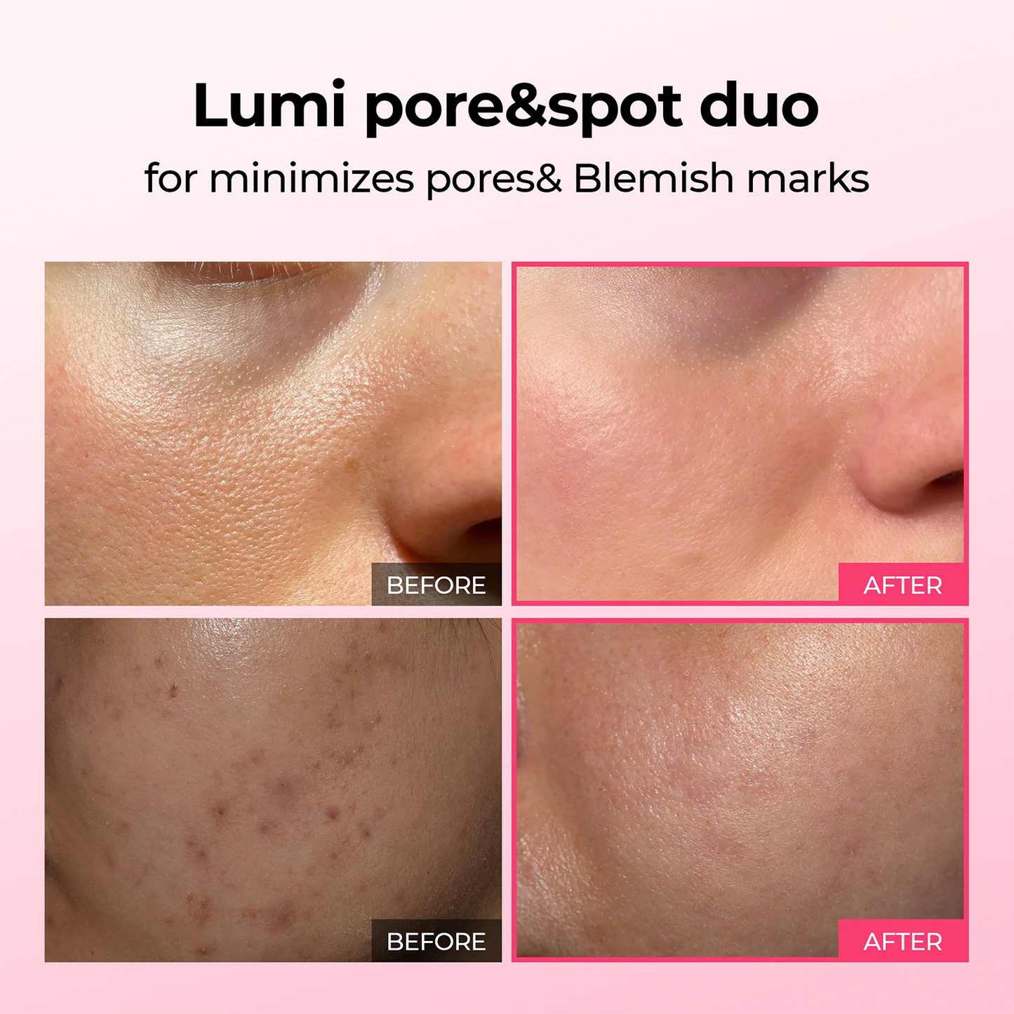 LUHAKA®  Pore & Spot Care Duo