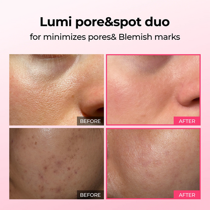 LUHAKA®  Pore & Spot Care Duo