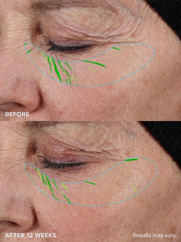 LUHAKA® DERMLOGI Growth Factor Serum