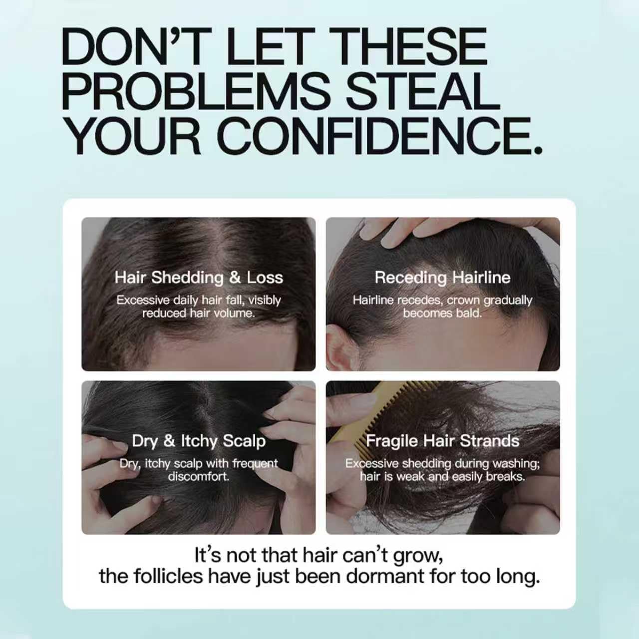 5% Minoxidil Scalp Moisturizer | Fuller-Looking Hair Starts Here