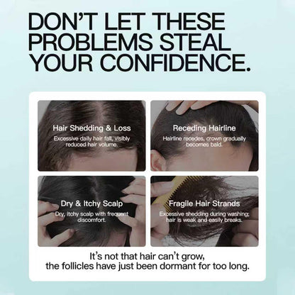 5% Minoxidil Scalp Moisturizer | Fuller-Looking Hair Starts Here