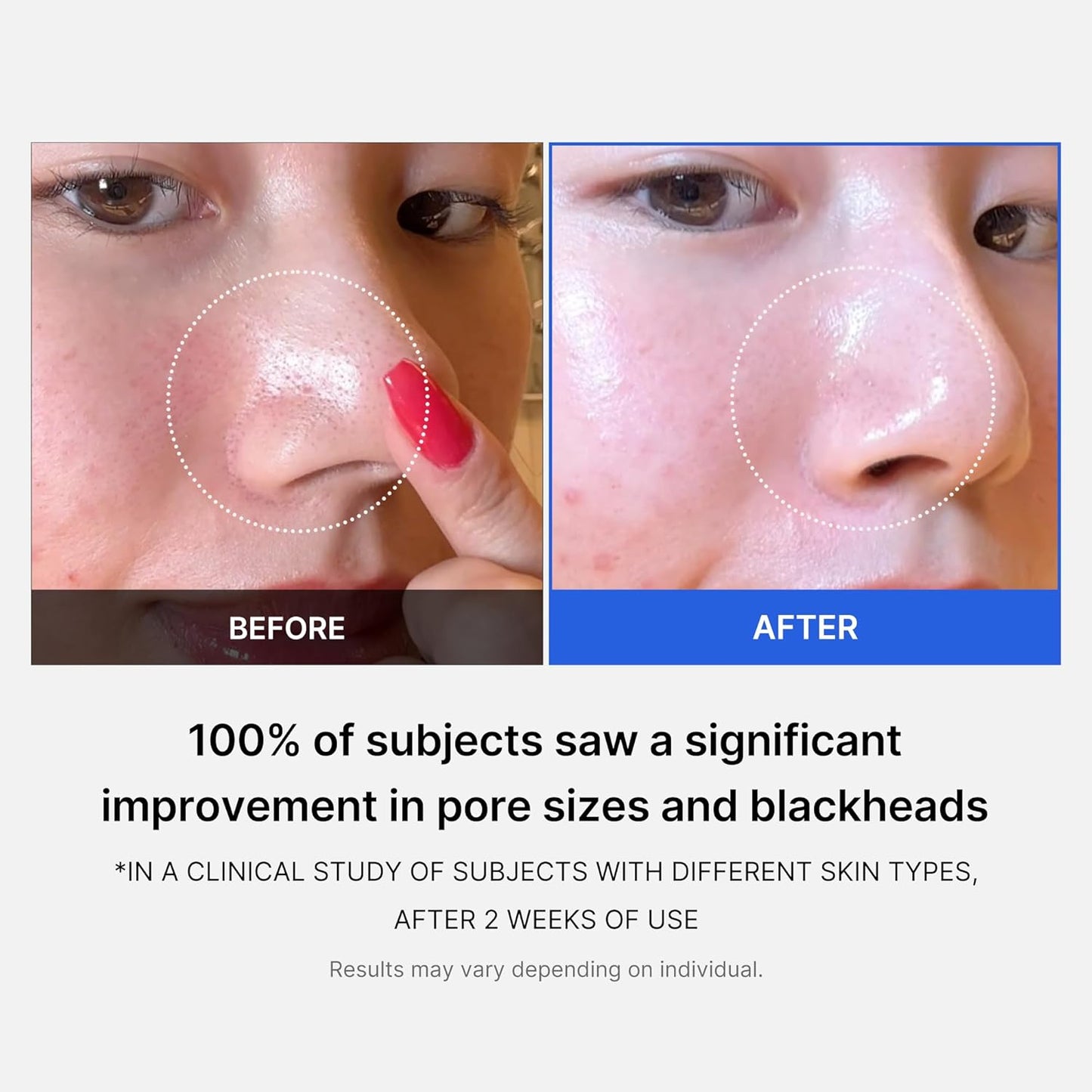 LUHAKA® Zero Pore Pad
