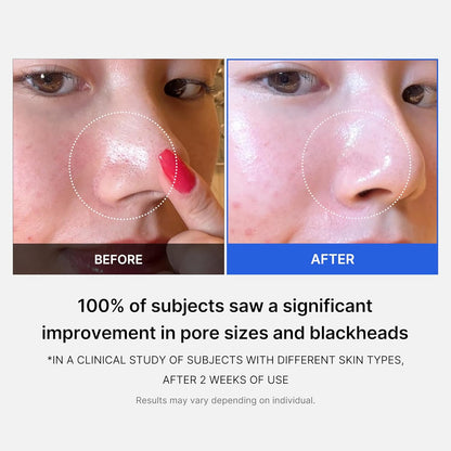 LUHAKA® Zero Pore Pad