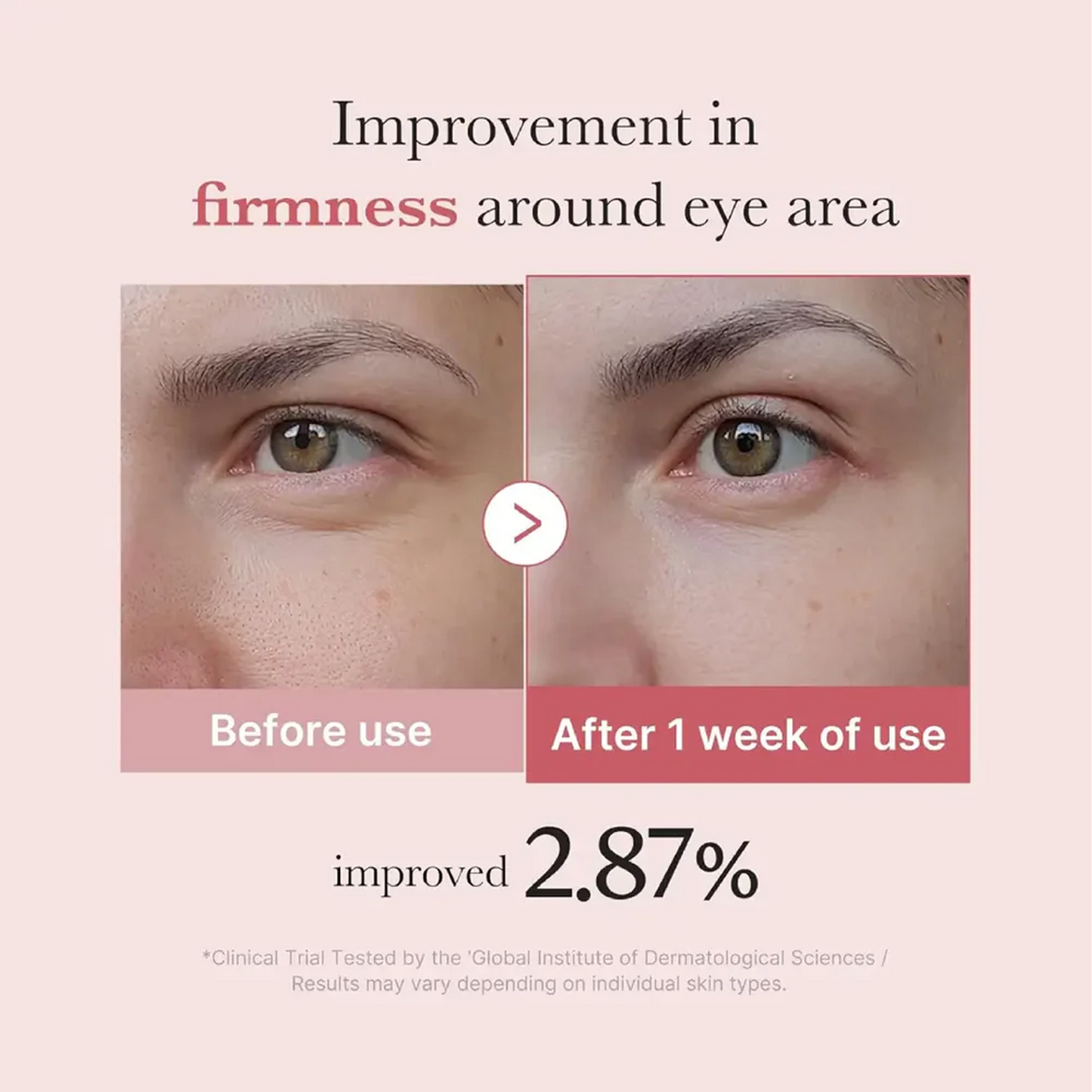 LUHAKA®  Salmon DNA PDRN Pink Peptide Eye Cream 30mL