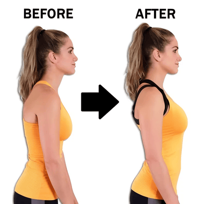 Sfrcord® 🔥2025 Summer Hot Sale 50% OFF-✨TrueForm Posture Correcting Bra