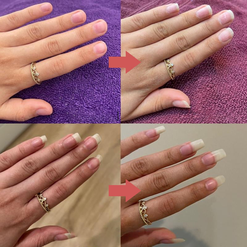 LUHAKA®  NailOil