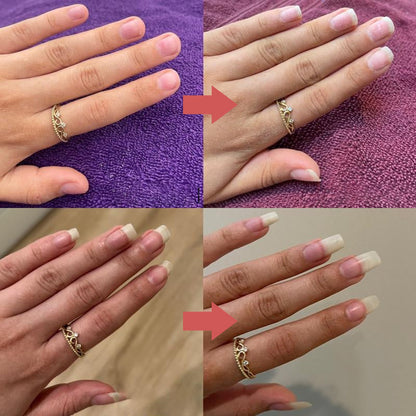 LUHAKA®  NailOil
