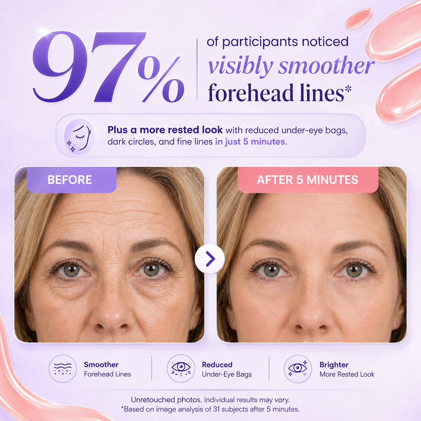 LUHAKA® Instant Lift Eye Gel, Fine Lines & Dark Circles