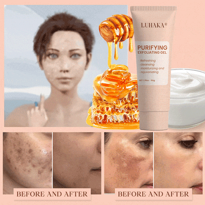 Luhaka® Purifying Exfoliating Gel ACE 1 for Acanthosis Nigricans, Exfoliation, Dark Spots, Skin Tags, and Eczema