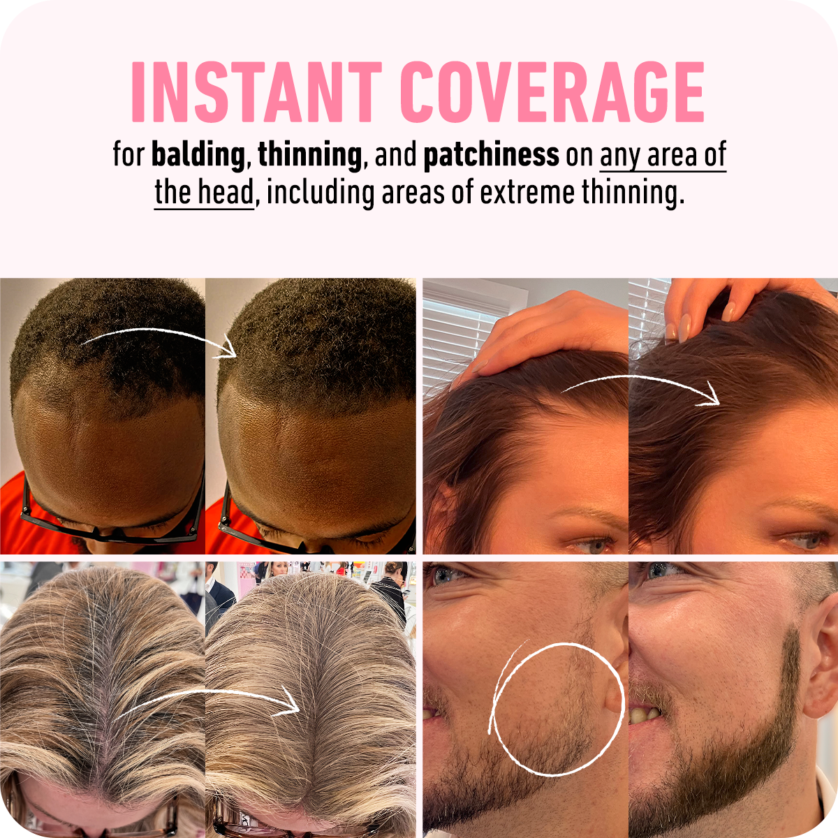 LUHAKA® Hairline Powder