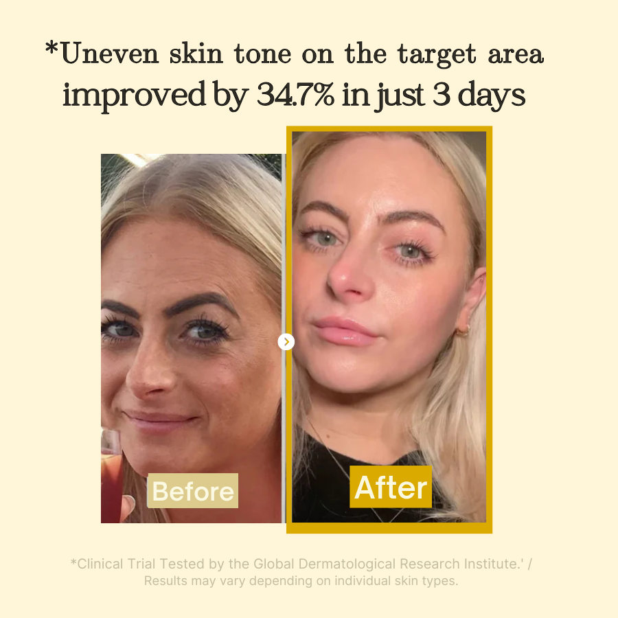 LUHAKA®  Kojic Acid Turmeric Night Wrapping Mask