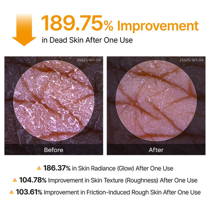 Luhaka® DermPeel Kojic Acid Turmeric Spray