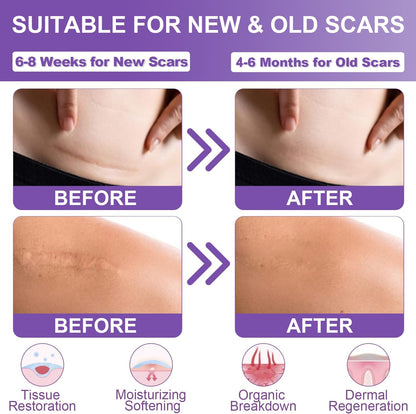LUHAKA® Silicone Scar Remover Tape for Acne & Wrinkles