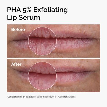 LUHAKA® PHA 5% Exfoliating Lip Serum