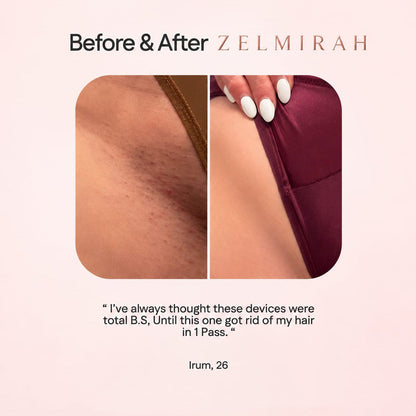 Velvet Glide | 2-in-1 Men & Women Body Shaver
