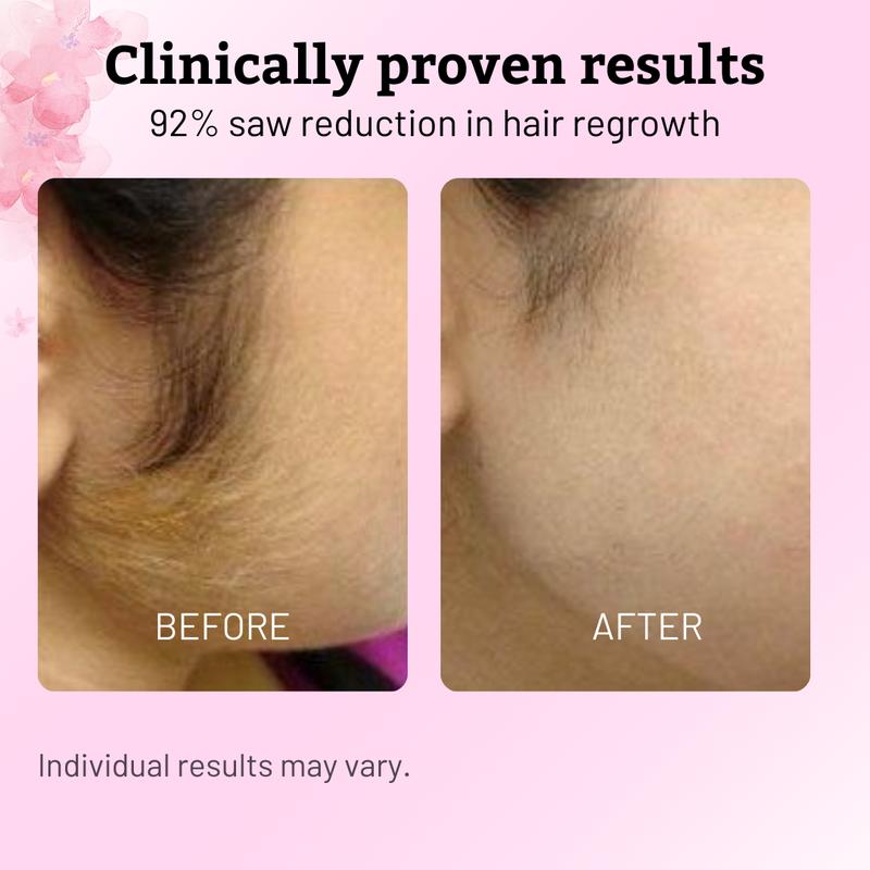 LUHAKA® 60ML Cyperus Rotundus Skin Serum,Cyperus Rotundu Oil for Hair Removal，Moisturizing Soothing Treatment for Sensitive Skin.