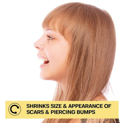 LUHAKA® Piercing Bump Solution I Keloid Bump Removal - Soothing Essential Oil for Piercing Bumps, Keloids & Scars | Nose, Ears, Body