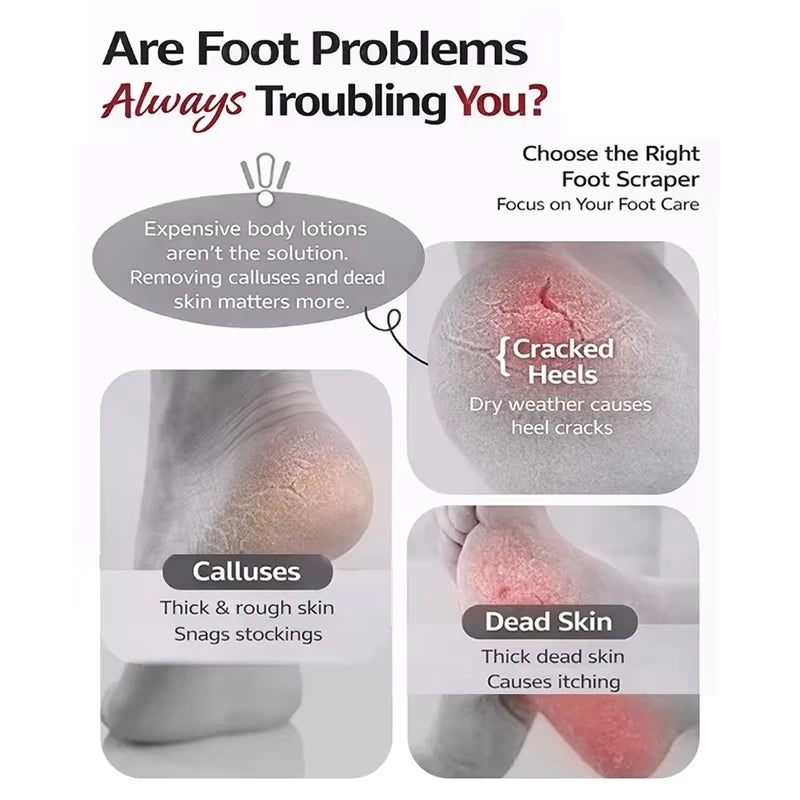 Double-Sided Foot File Callus Remover