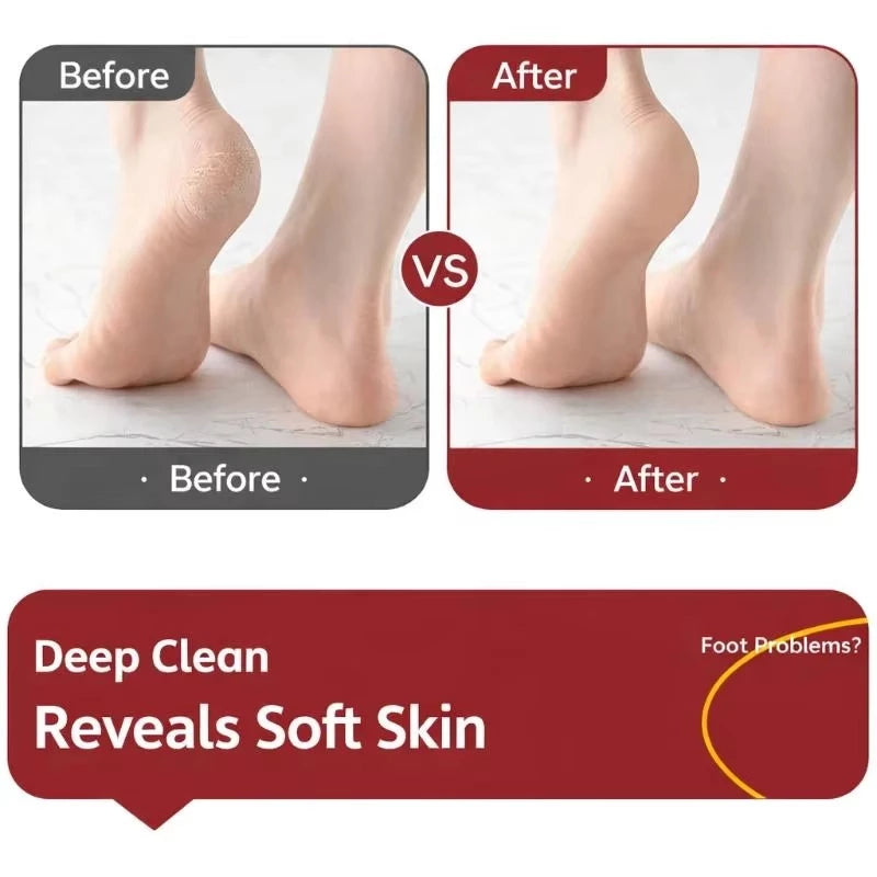 Double-Sided Foot File Callus Remover