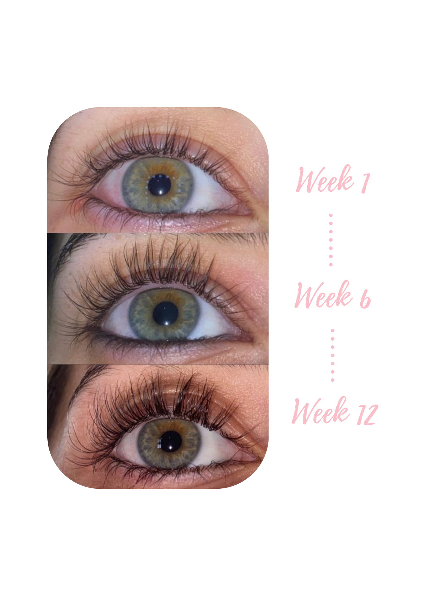 LUHAKA® Eyelash Serum 5ml