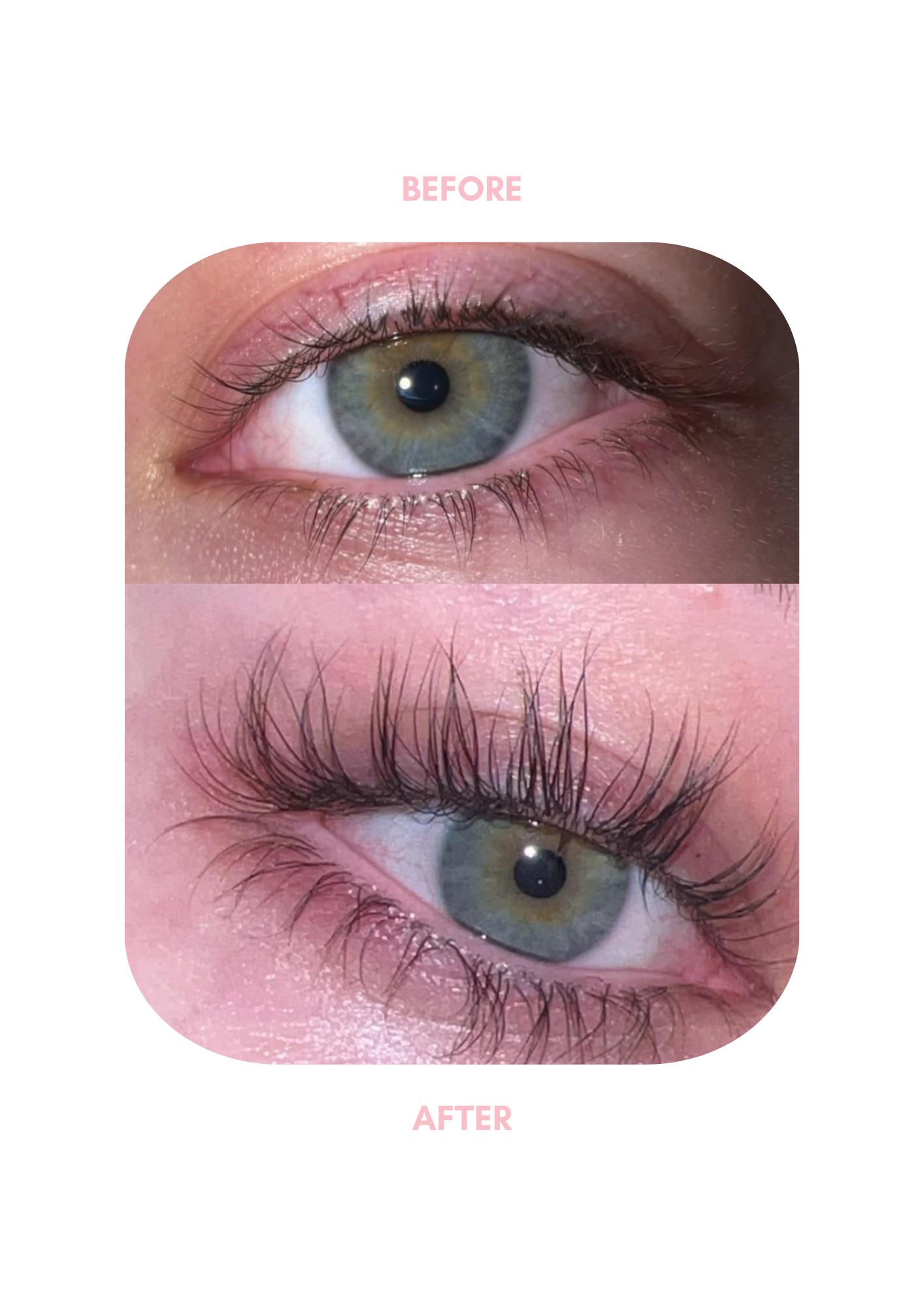 LUHAKA® Eyelash Serum 5ml