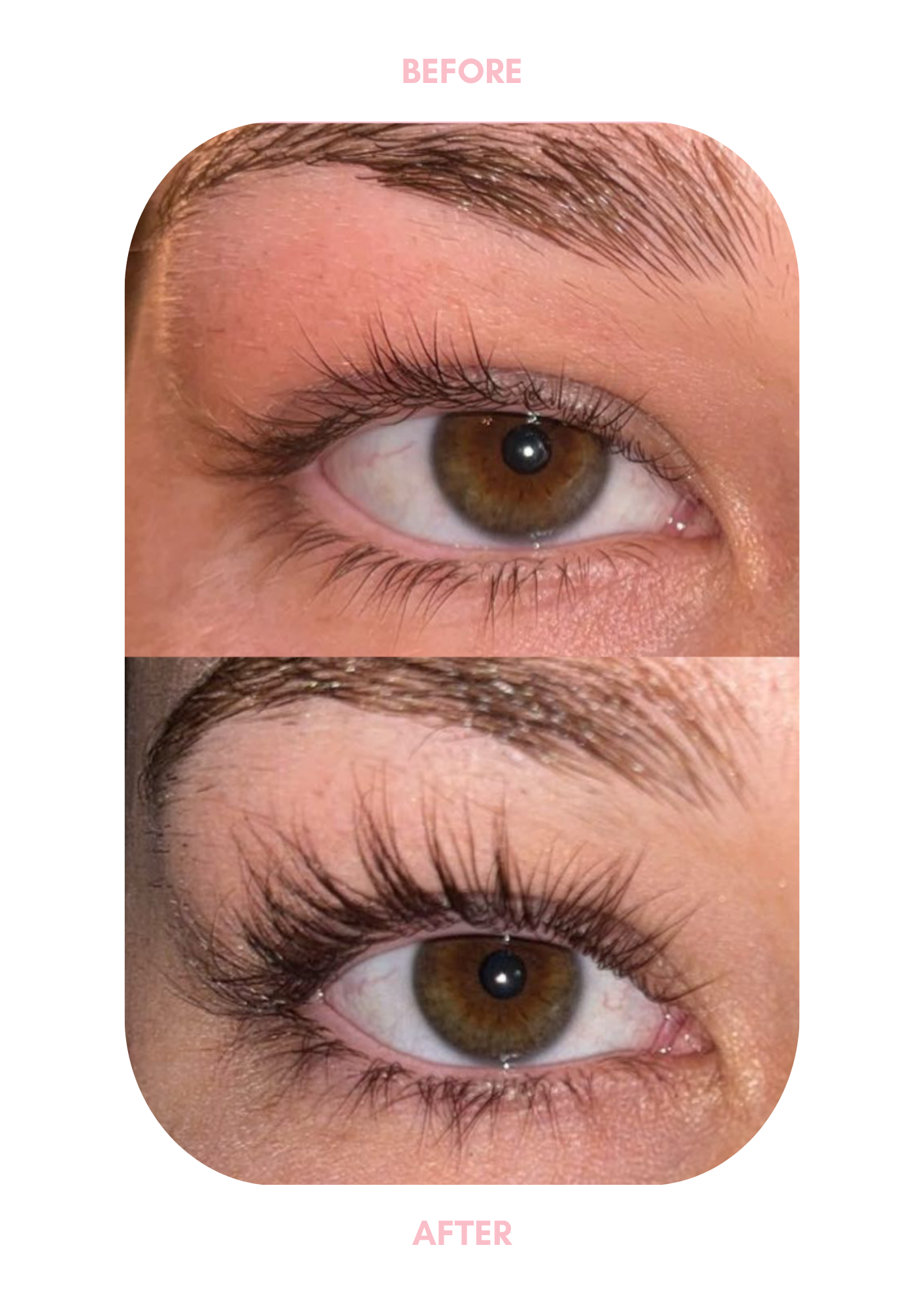 LUHAKA® Eyelash Serum 5ml
