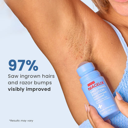 Luhaka® Niacelix Smoothing Solution Ingrown Hair Treatment