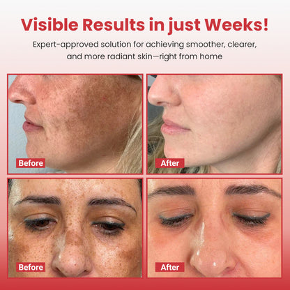 medloube Hypochlorous Acid Rice Peel Shot Duo