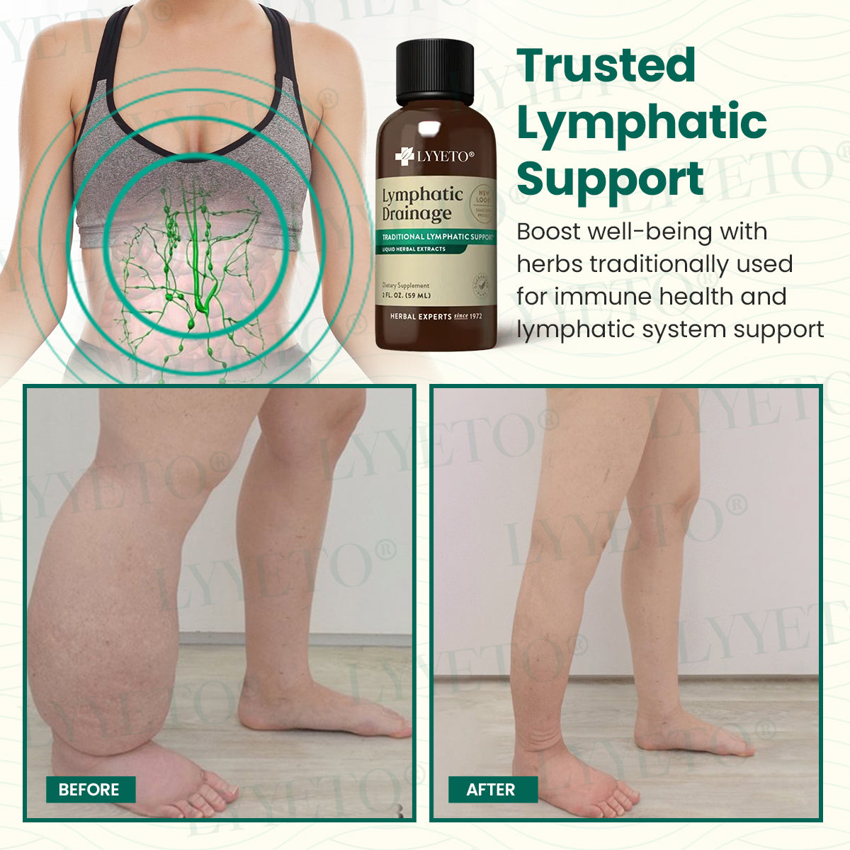 Lyyeto® Lymphatic Drainage with Liquid Herbal Extract