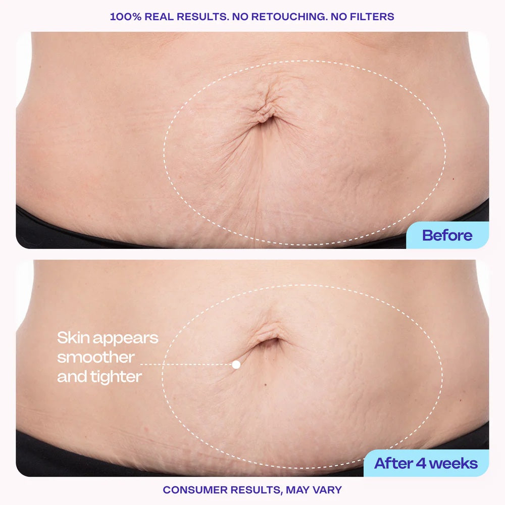 Luhaka® SOPURE Tighten & Smooth Belly Cream