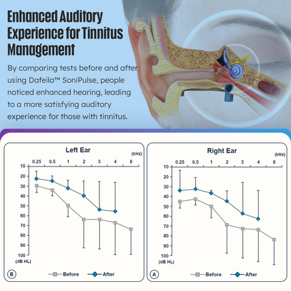 Anniversary Promotion💖Dafeila™ SoniPulse Tinnitus Relief Soothing Aid-K2🎧