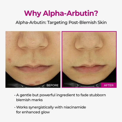 LUHAKA®  Pore & Spot Care Duo