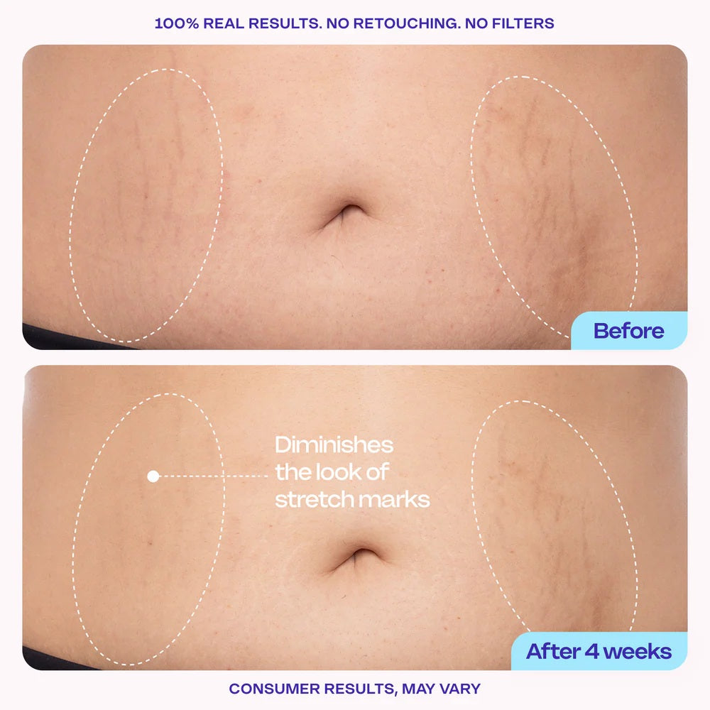 Luhaka® SOPURE Tighten & Smooth Belly Cream
