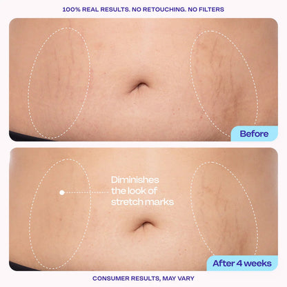Luhaka® SOPURE Tighten & Smooth Belly Cream