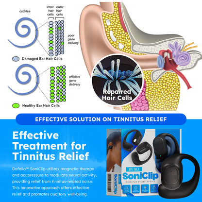 🔥Anniversary Promotion🌐Dafeila™ SoniClip Tinnitus Relief Device