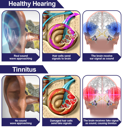 ✨DAFEILA™ INFRAPEACE -Red Light Therapy Ear Plugs